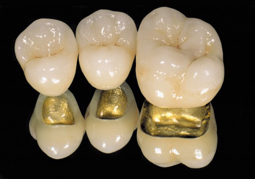 phuc-hinh-su-ban-quy-15